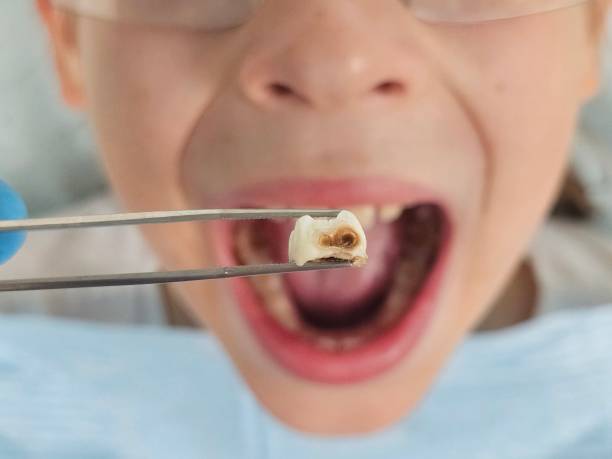Best Tooth Infection Emergency Dentist  in Slippery Rock University, PA